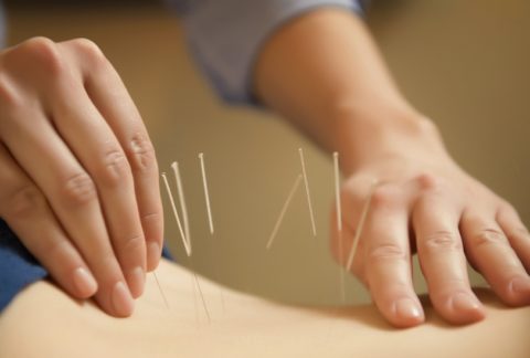 L'Acupuncture